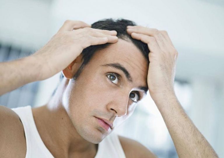 رفع ریزش شدید مو با روشهای خانگی و طبیعی رفع ریزش شدید مو با روشهای خانگی و طبیعی