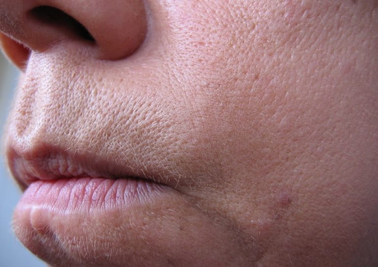 برای بسته شدن منافذ پوست صورت از این ماسک های فوق العاده استفاده کنید برای بسته شدن منافذ پوست صورت از این ماسک های فوق العاده استفاده کنید