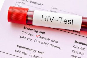 تفاوت ایدز و اچ آی وی چیست؟
