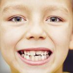 علت سیاه شدن دندان ها و راه های درمان