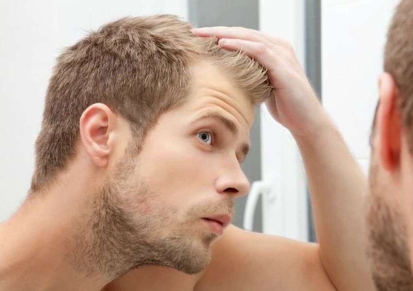 ۲۰ علت ریزش مو در مردان و زنان