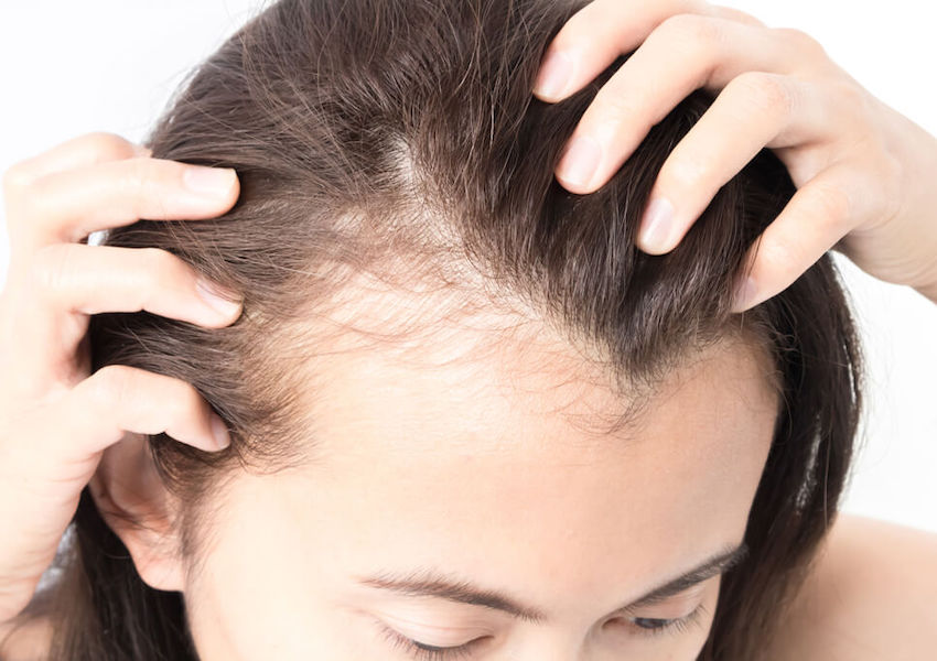 بیوتین چیست؟ آیا برای درمان ریزش مو مناسب است؟