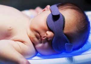 زردی نوزاد؛ علائم، دلایل و روش های درمان