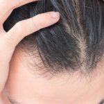 درمان ریزش مو با پانزده ماسک طبیعی و موثر