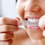 برای داشتن دندان و لثه هایی سالم چه باید کرد؟