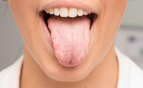 ۲۱ روش برای رفع خشکی دهان
