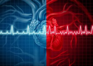 فیبریلاسیون دهلیزی ؛ علائم، دلایل، عوارض، درمان و پیشگیری