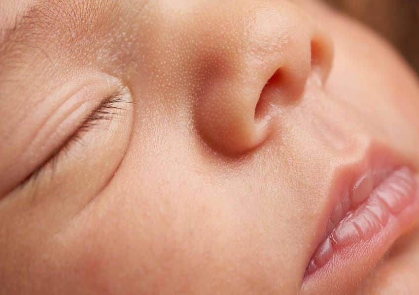 ترک خوردن لب نوزاد ؛ از دلایل تا درمان خانگی و پیشگیری