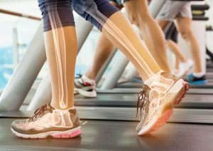 علت درد ساق پا بعد از دویدن و نحوه پیشگیری و درمان آن