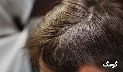 شش علت اصلی آسیب دیدن موها چه هستند؟