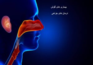 درمان های جراحی برای بیماری های گوش