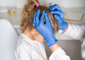 شپش سر در کودکان و درمان توسط دکتر کودکان