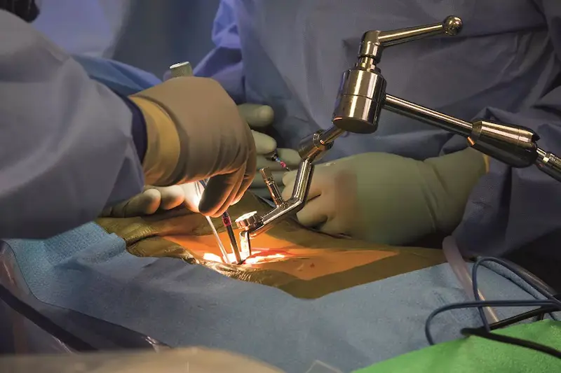 خطرناک ترین عوارض جراحی دیسک و ستون فقرات چیست؟