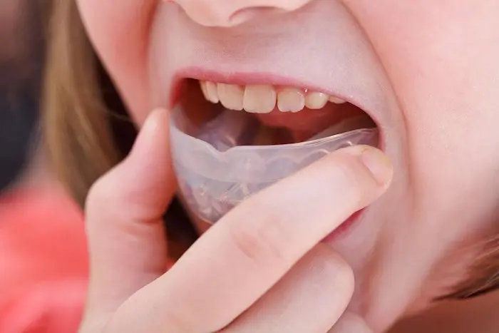 ترمیم دندان شکسته + انواع روش های درمان