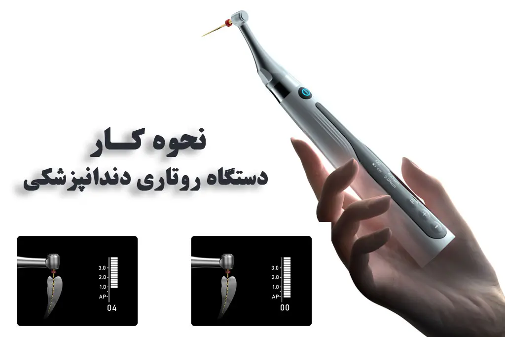 نحوه کار دستگاه روتاری دندانپزشکی