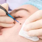 معرفی خدمات متخصص پوست و مو