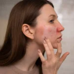زن در حال استفاده از کرم روی پوست صورت
