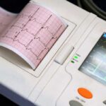 دستگاه نوار قلب در حال پرینت