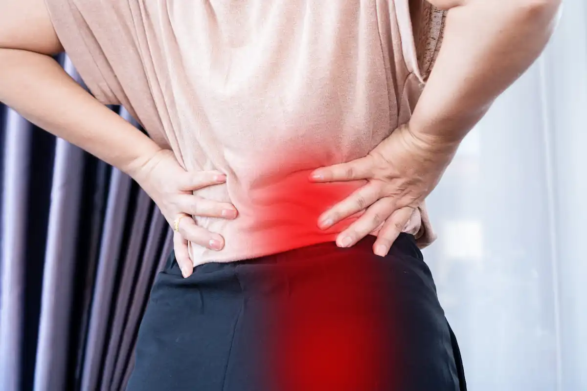 سیاتیک چیست؟ همهچیز درباره درد سیاتیک