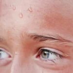 عرق زیاد سر و صورت