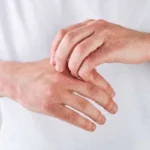 فرق اگزما و قارچ
