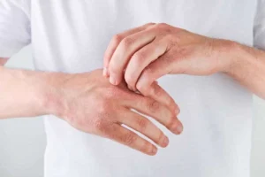 فرق اگزما و قارچ