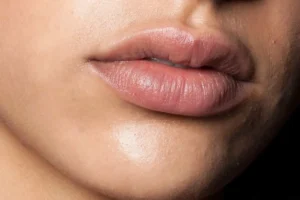 روشن شدن رنگ لب