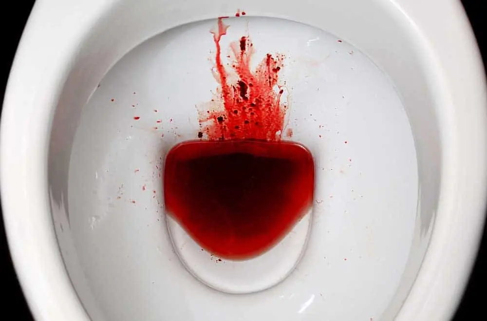 Blood in the Stools: Possible Causes of Rectal Bleeding