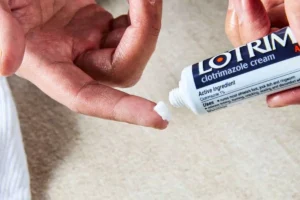 پماد کلوتریمازول