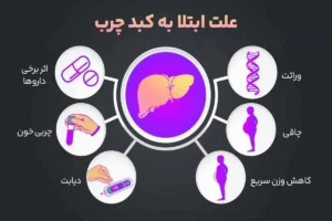 علائم ابتلا به کبد چرب