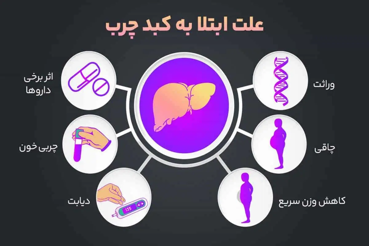 علائم ابتلا به کبد چرب