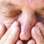 داروهای گرفتگی بینی