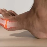 علت درد انگشت شست پا؛ آیا باید نگران باشیم؟