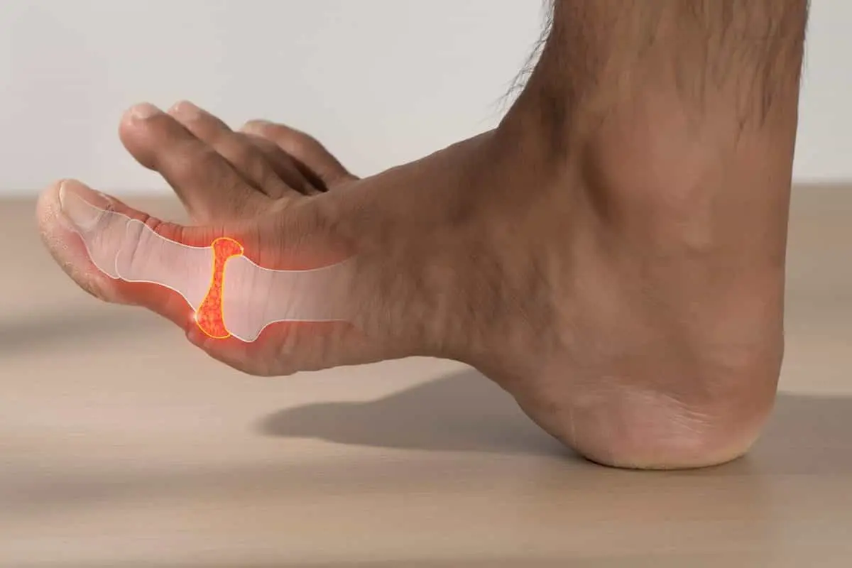 علت درد انگشت شست پا؛ آیا باید نگران باشیم؟
