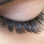 علت شوره مژه چیست و چگونه آن را از بین ببریم؟