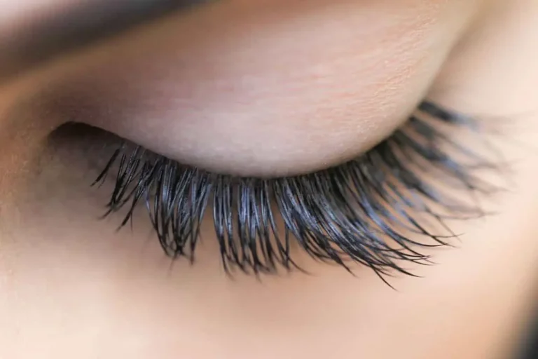 علت شوره مژه چیست و چگونه آن را از بین ببریم؟