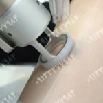 مراقبت‌های قبل و بعد از لیزر موهای زائد در اصفهان