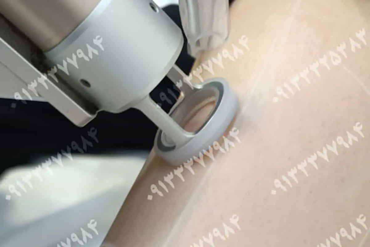 مراقبت‌های قبل و بعد از لیزر موهای زائد در اصفهان