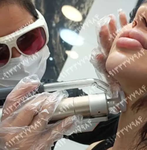 مراقبت‌های قبل و بعد از لیزر موهای زائد در اصفهان