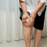 رابطه چاقی و زانو درد + روش های مقابله با آن