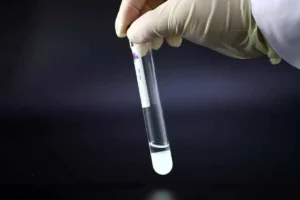 آزمایش اپیوم چیست و چقدر دقیق است؟