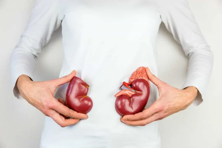 علائم کلیه سنگ ساز | چگونه بفهمیم کلیه هایمان سنگ می سازند؟