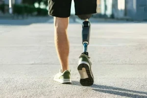 انواع پروتز پای مصنوعی و کاربرد هر کدام