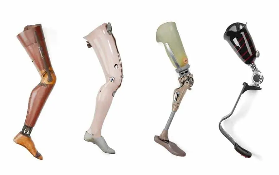Types of Leg Prosthesis