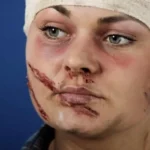 تفاوت دیه در آسیب‌های مختلف ناحیه فک و صورت؛ راهنمای کامل و به‌روزرسانی‌شده ۱۴۰۴