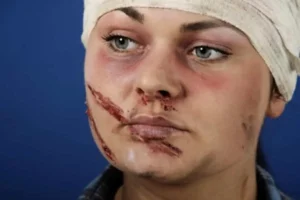 تفاوت دیه در آسیبهای مختلف ناحیه فک و صورت؛ راهنمای کامل و بهروزرسانیشده ۱۴۰۴