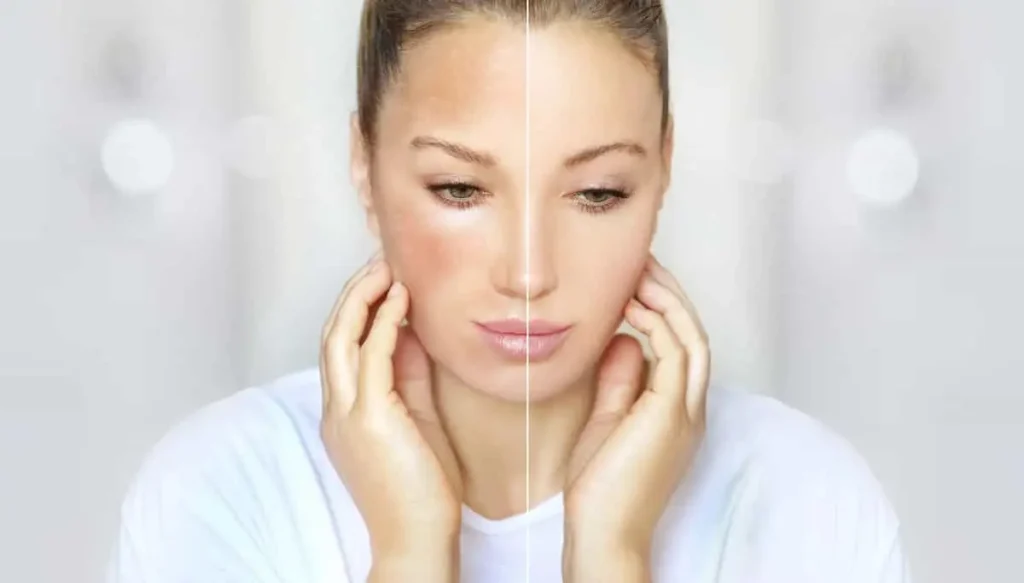 چطور پوستمان را سفید کنیم؟ مثل ماه بدرخشید!