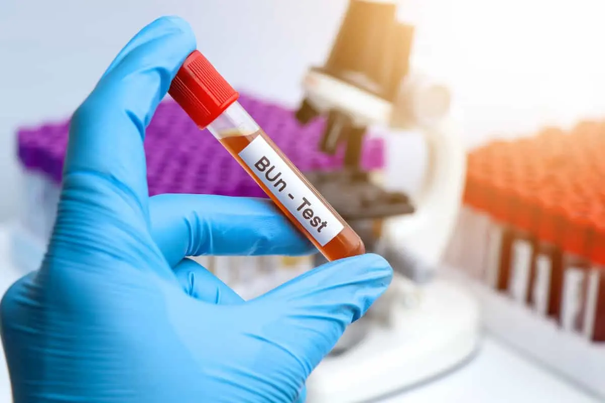 میزان نرمال اوره خون چقدر است؟