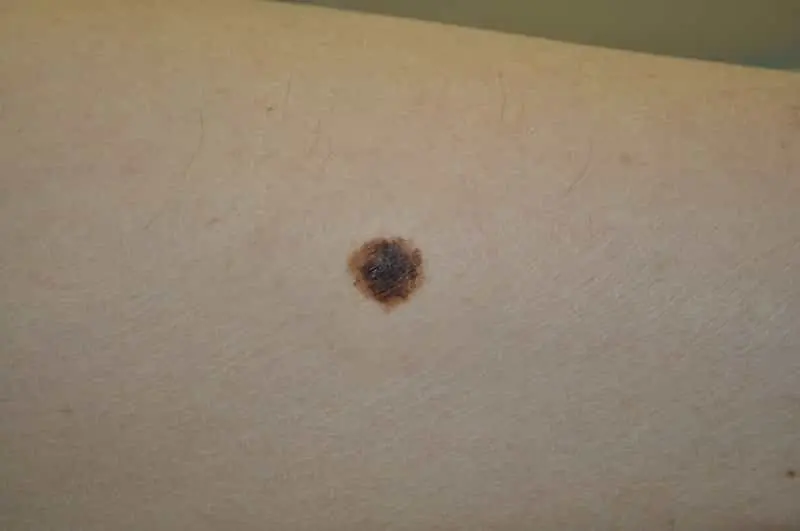 C – Color (تغییر رنگ یا چندرنگ بودن)