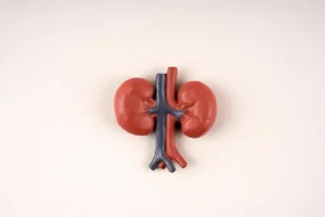 کراتینین چرا بالا می‌رود و درمان فوری آن چیست؟